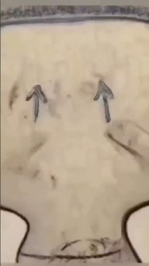 Powerful Massage Technique to Relieve Stress