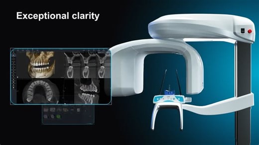 X-Mind Optima 3D from Acteon