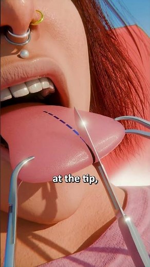How Tongue Splitting Is Done 🤯