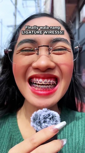 Teeth Braces Journey: Upgrading Your Smile