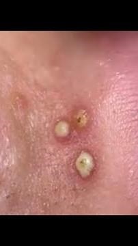 Cravos 😱