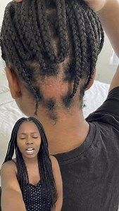My mans pulled my edges with the hard bristle brush instead of the soft one😅 Here’s what I used to grow it back… it hurt so bad…💀 #type4hair #hairgrowth #hairloss #boxbraids #hairoil | Haley Loves Hair