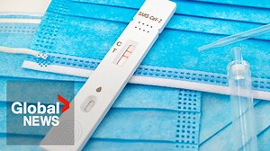 A genetic mutation may protect against COVID-19: University of California San Francisco researchers - The Global Herald