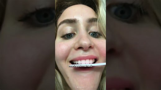 How to survive the TikTok veneer trend safely
