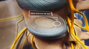 30K views · 200 reactions | Learn about the available treatments for...