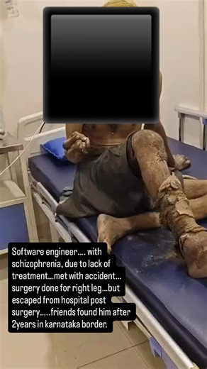 Bharosa Neuro Psychiatry Hospital on Instagram: "Today, we want to share the journey of a young man who was once a 28-year-old software engineer, full of dreams and potential. After the sudden loss of his mother, he developed schizophrenia. In the early phase of his illness, there was no one to look after him. The illness went untreated. During this vulnerable period, he met with a road traffic accident and underwent surgery on his right leg. But his mental illness took out of control. He escape