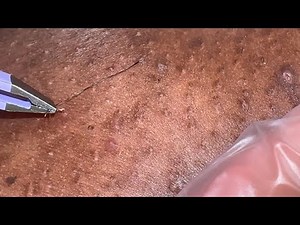 Extractions from Nude Episode 28 Preview