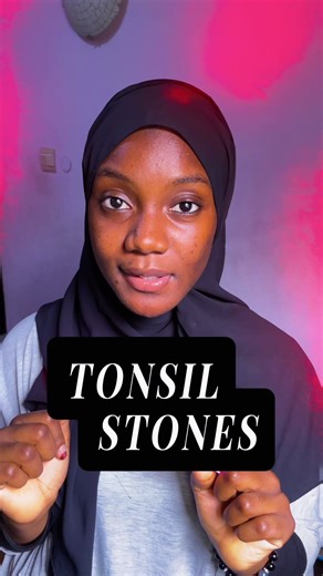 Understanding and Overcoming Bad Breath Issues