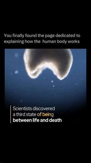 The Human Body 🧬 on Instagram: "Follow @explainingthebody to learn everything about the human body one post at a time 🧠⚙️ The concept of a “third state of being” between life and death refers to groundbreaking research in cellular science that challenges our traditional, binary understanding of death. This work explores what happens to the body’s cells immediately after the heart stops and circulation ceases. For centuries, death was viewed as a single, irreversible moment when all biological 