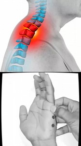Accu Point Presure Dots | Healing Therapy