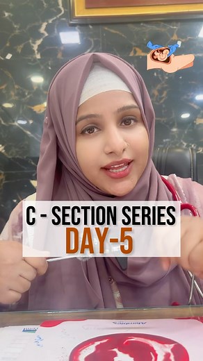 Dr. Sadaf Nehal | Gynecologist & Female Health Expert on Instagram: "Why a C-section might be necessary if baby poops in the womb (meconium in 9th month) 🍼🚨 Sometimes, around the 9th month, babies can pass their first poop (called meconium) inside the womb. While it can be harmless, it may also signal fetal distress — meaning baby isn’t coping well inside. Here’s why this matters: ➡️ If the baby inhales the meconium-stained fluid, it can lead to Meconium Aspiration Syndrome (MAS) — causing ser