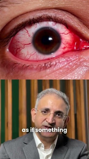 Burning, Irritated Eyes? It Could Be Dry Eye | Dr. Bisla Explains
