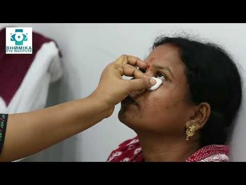 How to Instill Eye Drops Properly | Bhoomika Eye Institute