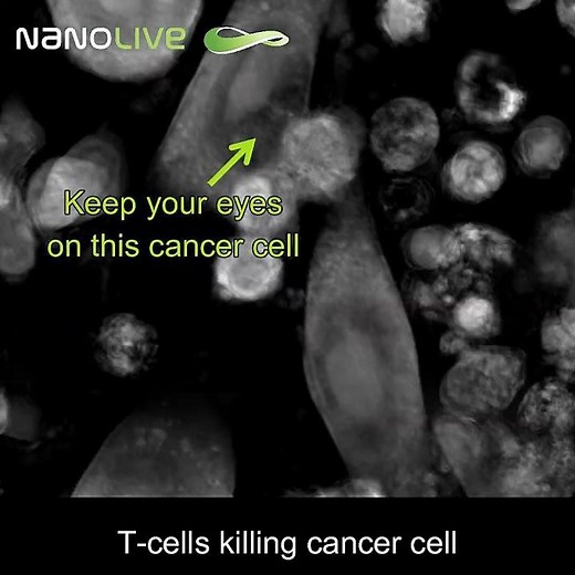 Label-free live cell imaging, T cells killing cancer cells