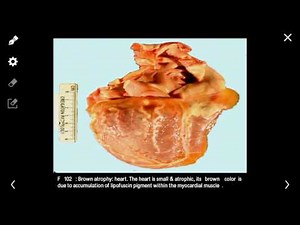 Pathology-lect6 -part2