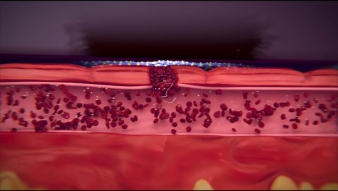 Rapid Seal 15pc Hemostatic First Aid Wound Care Kit | Stops Bleeding in Seconds | Quick Effective Bleed Control | for Blood Clotting, Trauma Kit, Survival Gear and Supplies