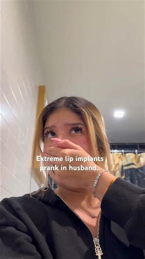 JUMBO LIP PRANK ON HUSBAND! 😳 #pranks