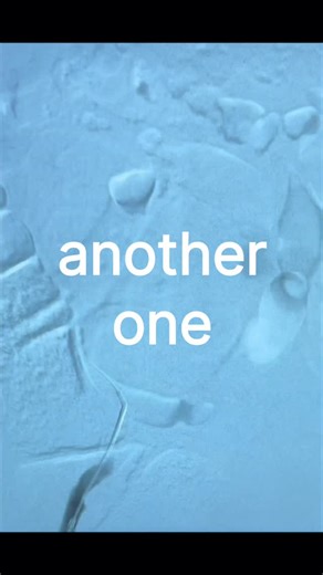 That Vascular Life 喝  on Instagram: "I eat beef for breakfast . . . #vascular #vascularsurgery #vascularsurgeon #orlife #surgery #operatingroom #surgeonlife #surgical #surgerylife #surgeon #endovascular #stent #angio #aorta #anuerysm #angiography #cathlab #surgicaltech #scrubtech #scrubnurse #ornurse #surgicalnurse #anesthesia #doctor #doctorlife #scrubslife #medicaldsvices #medicaldevice #medicine #disstrack"