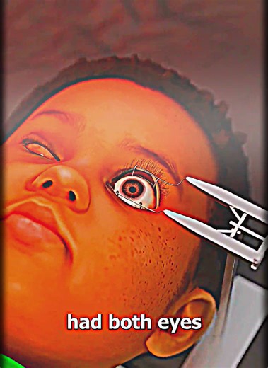 Echolocation: The Blind Man Who Rides a Bike