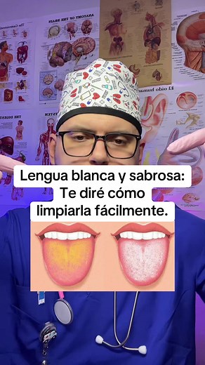 Cómo limpiar la lengua blanca para un mejor aliento