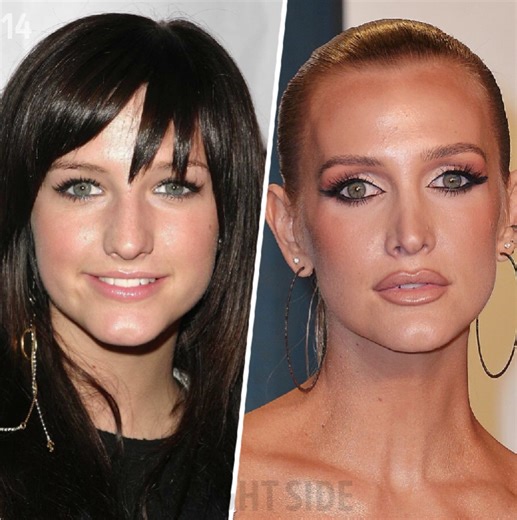 30 Celebrities Who Transformed Dramatically Right Before Our Eyes | Bright Side