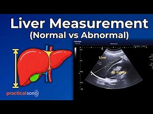 Liver Size Ultrasound: Stop Measuring It Wrong