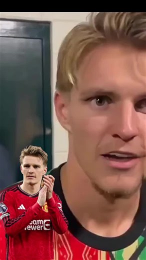 Martin Ødegaard Transfer to Manchester United