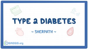 Video Case Study - Type 2 Diabetes: Video, Causes, & Meaning | Osmosis