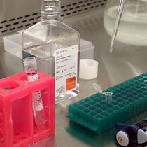 Video: A "Patient-Like" Orthotopic Syngeneic Mouse Model of Hepatocellular Carcinoma Metastasis