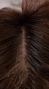 Mind-Blowingly Simple Tricks You’ll Use Every Day! 🔧💡 | 5-Minute Crafts Teens