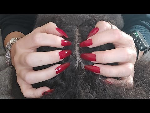 ASMR Scratching Your Itchy Scalp | Over 1 Hour Loop | No Talking 💆‍♀️ ✨️ #asmr