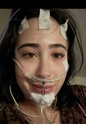 mind the crusties all over me, they use gooo to stick the nodes on #fyp #narcolepsy