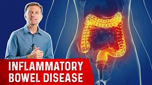 IBD Nutrition: Top Nutrient Deficiency & Fixes | Dr. Berg