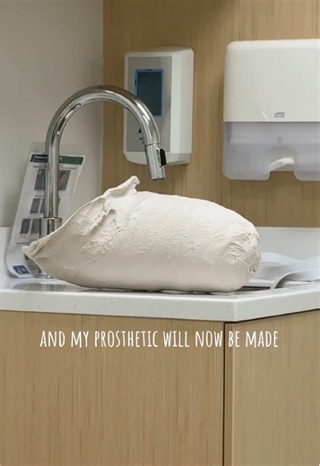 Meet Stubby: My Journey with a Prosthetic Leg