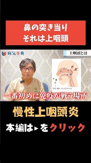 【慢性上咽頭炎】症状が3週間以上続く喉の病気#Bスポット #耳鼻科 #病気解説