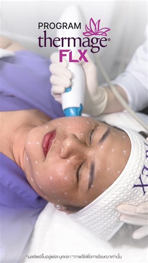 #แม่พลอย - แม่น้องญดา นริลญา เลือกดูแลปัญหาผิวแบบวัย 50 ที่ APEX โดย คุณหมอโอม นพ.ปรัชญนันท์ ปิยะพิพัฒน์ | ว.36027 โปรแกรม Thermage FLX #เหมาหัว หดแฟต ยกหน้าเฟิร์ม กระชับลดริ้วรอย . 💠 กระตุ้นคอลลาเจน กระชับผิว แน่น เฟิร์ม 💠 ยกกระชับตรงจุด ผิวหดตึง 💠 เน้นงานผิว ลดริ้วรอย กระชับรูขุมขน 💠 Face Tip ลดไขมัน เก็บผิวคล้อย กรอบหน้าคมชัด 💠 Eye Tip ยกตาตก ลดริ้วรอยรอบดวงตา . ปรึกษา​คลิก‼️ >> bit.ly/3Eeoi3B 📱 LINE ID : apexlifting ☎️ Call 085-000-0855 . *ผลลัพธ์ขึ้นอยู่กับสภาพผิวของแต่ละบุคคล #Therma