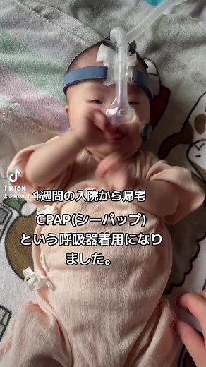 CPAP着用になった赤ちゃんの日常 - 効果的な使用方法と注意点