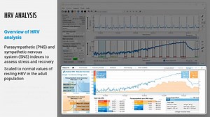 【科研必备】Kubios HRV Scientific 完全入门指南｜从安装到基础分析｜中国代理@科采通Scivaro