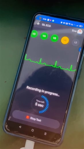 DR.Siva Sundar MBBS,MD(General medicine) on Instagram: "🫀 This tiny device could save a life. This is the Sunfox Spandan ECG – a portable, 12-lead ECG machine that works without internet or battery, and emits zero radiation. 📱 Just connect it to an Android phone, and in 90 seconds, you get a clinical-grade ECG — right from home. 🚑 It can detect heart attacks, arrhythmias, and abnormal rhythms — even before help arrives. In an emergency, acting early can make all the difference. 👨‍⚕️ A smart 