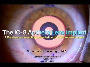 The IC-8 Apthera presbyopia-correcting extended depth of focus lens implant. Under-the-microscope.