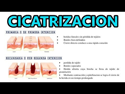 🔴 TIPOS DE CICATRIZACION