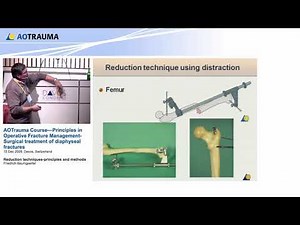 Reduction techniques principles and methods