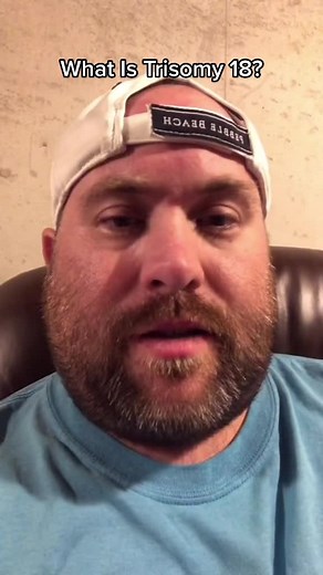 Understanding Edwards Syndrome: A Parent's Journey