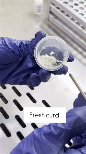 Dr. Shweta on Instagram: "Sahi bole hai @dr_cuterus i just had to make this video after watching this! Indeed dahi wale bacteria vagina mein hote hai!! Heres a demo! #microbiology #doctorsofinstagram #curd #doctors #goodbacteria #vaginalhealth #microscope #mbbs #laboratorylife"