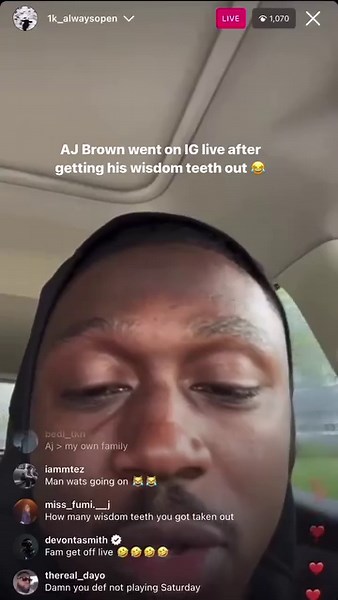 76K views · 18 reactions | AJ Brown went on IG live after getting his wisdom teeth out  (: AJ Brown) | CBS Sports | Facebook