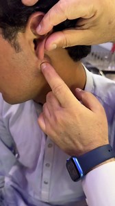 480K views · 1.7K reactions | Parotid cystic mass if left for long can be malignant | Dr Bakht Zada | Facebook