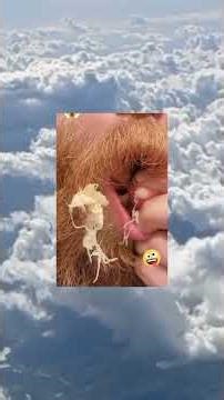 Ear cyst 👀