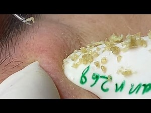 Satisfying With Loan Nguyen Spa Video #056
