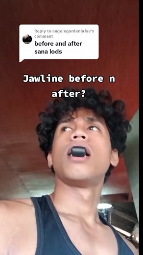 Jawline Transformation Before and After: See the Results!