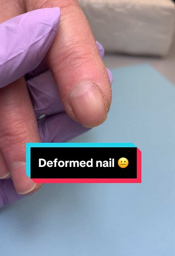 Fixing Deformed Nail with Long Natural Gel Polish